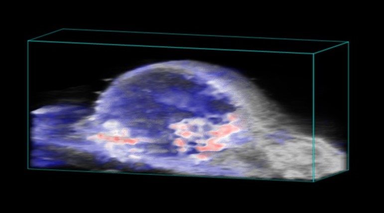 光音響を使用して画像化されたマウス皮下腫瘍の酸素飽和度